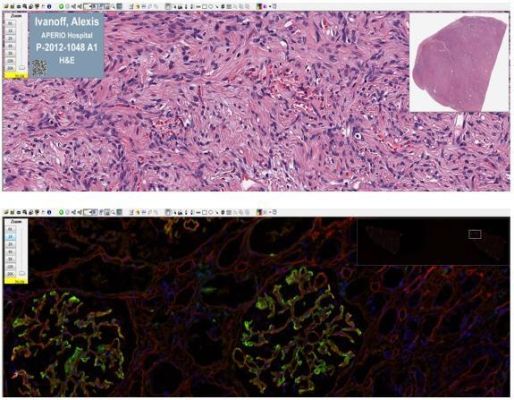 Software Pentru Vizualizarea Lamelor Patologice Aperio ImageScope